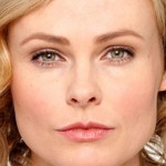 BOTOX® Cosmetic