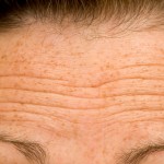 Wrinkles